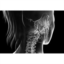Lade das Bild in den Galerie-Viewer, Acrylglasbild Anatomische Röntgenkunst Querformat