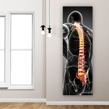 Lade das Bild in den Galerie-Viewer, Aluminiumbild gebürstet Rückenschmerzen Anatomie Panorama Hoch