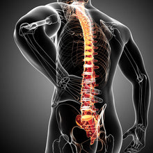 Lade das Bild in den Galerie-Viewer, Spannrahmenbild Rückenschmerzen Anatomie Quadrat