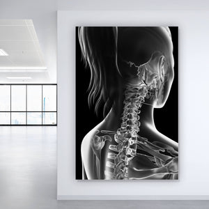 Aluminiumbild gebürstet Anatomische Röntgenkunst Hochformat