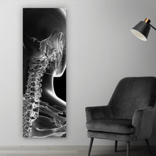 Lade das Bild in den Galerie-Viewer, Aluminiumbild Anatomische Röntgenkunst Panorama Hoch
