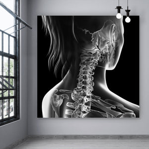 Aluminiumbild gebürstet Anatomische Röntgenkunst Quadrat