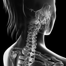 Lade das Bild in den Galerie-Viewer, Aluminiumbild gebürstet Anatomische Röntgenkunst Quadrat
