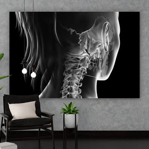 Aluminiumbild gebürstet Anatomische Röntgenkunst Querformat