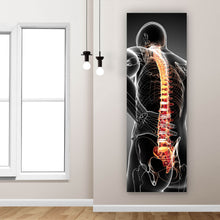 Lade das Bild in den Galerie-Viewer, Aluminiumbild Rückenschmerzen Anatomie Panorama Hoch
