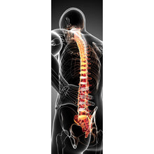 Lade das Bild in den Galerie-Viewer, Leinwandbild Rückenschmerzen Anatomie Panorama Hoch
