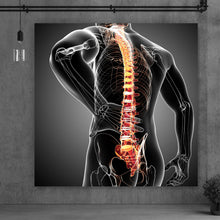 Lade das Bild in den Galerie-Viewer, Leinwandbild Rückenschmerzen Anatomie Quadrat
