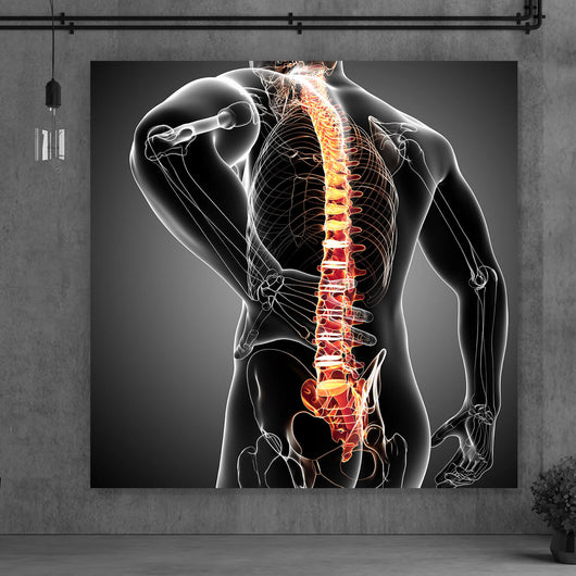 Leinwandbild Rückenschmerzen Anatomie Quadrat