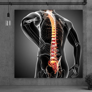 Acrylglasbild Rückenschmerzen Anatomie Quadrat