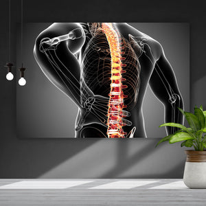 Leinwandbild Rückenschmerzen Anatomie Querformat